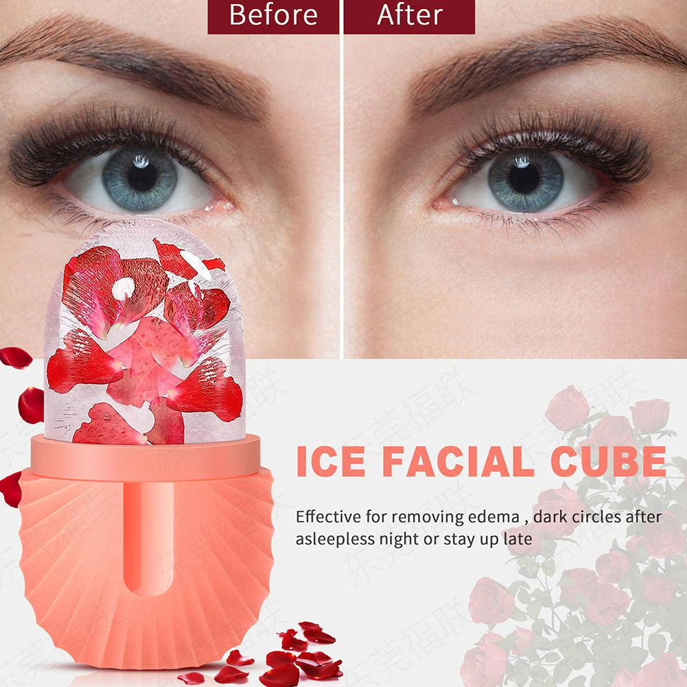 ICE FACE REMOVAL