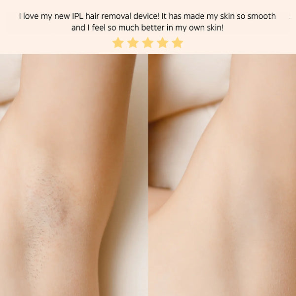 IPL HAIR REMOVAL