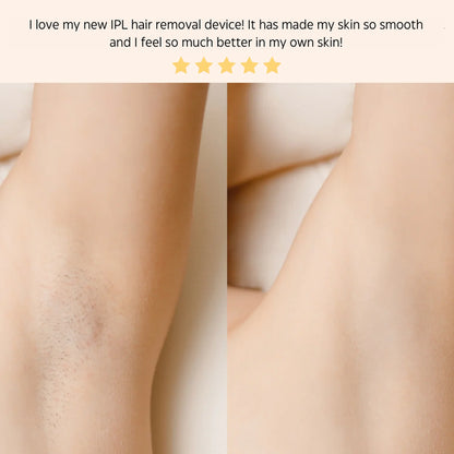 IPL HAIR REMOVAL