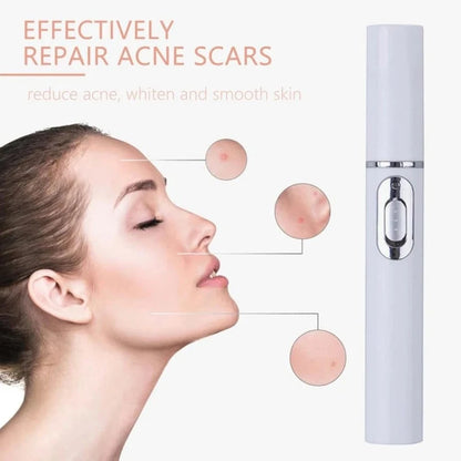 BLUE LIGHT ACNE THERAPY