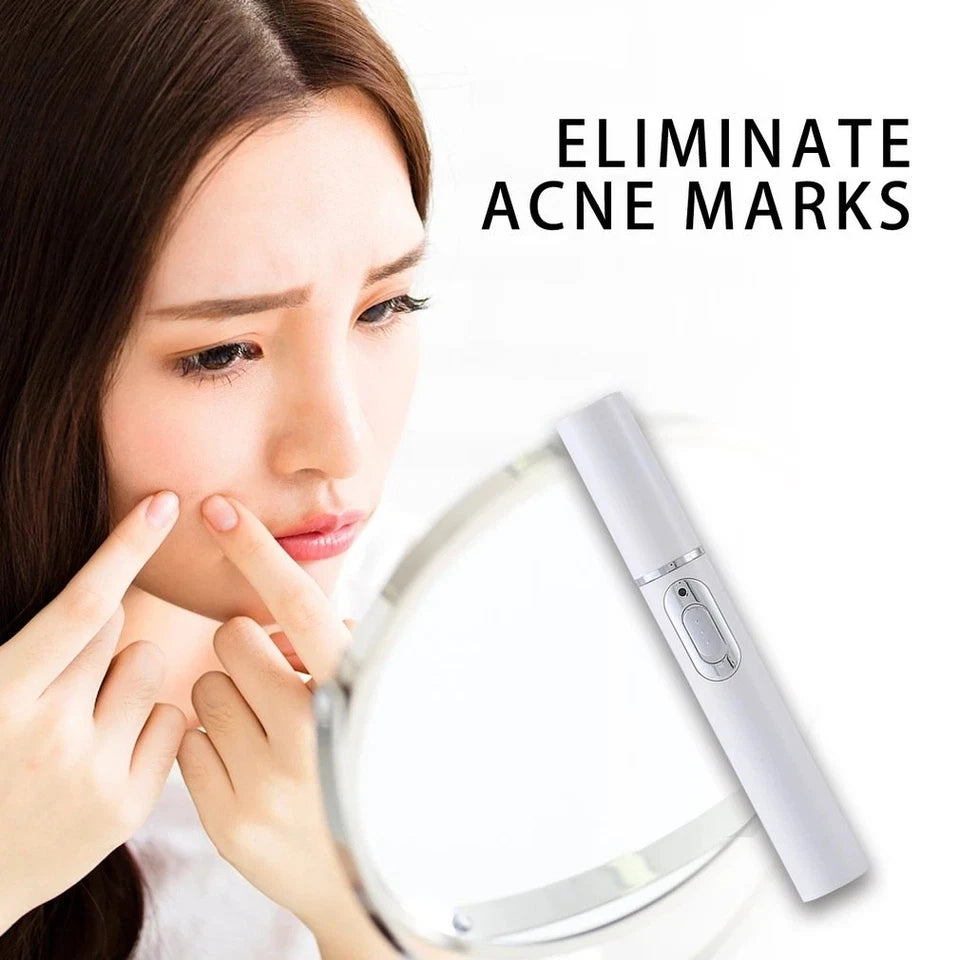 BLUE LIGHT ACNE THERAPY